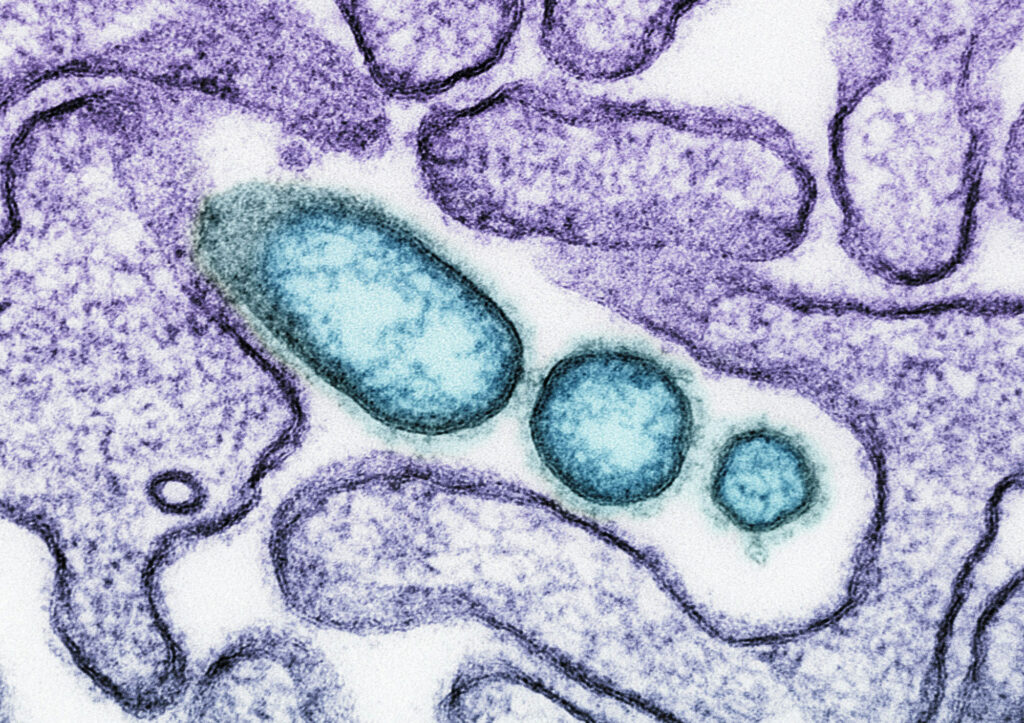 A close up of an animal cell